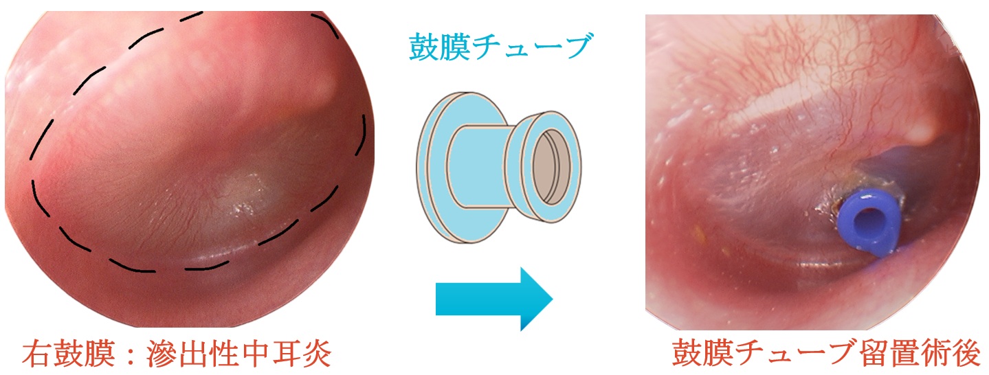 耳の構造、外耳、中耳、内耳